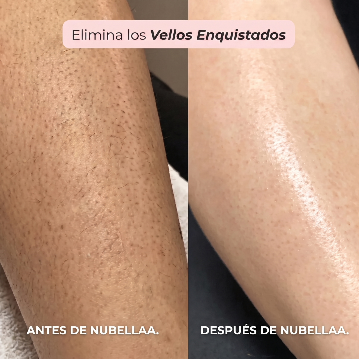 RASURADORA 2 EN 1 PARA BIKINI Y CUERPO · NUBELLAA™